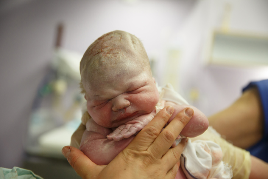 Naborana sluzava koža male bebe prvo je što novopečeni roditelji ugledaju.