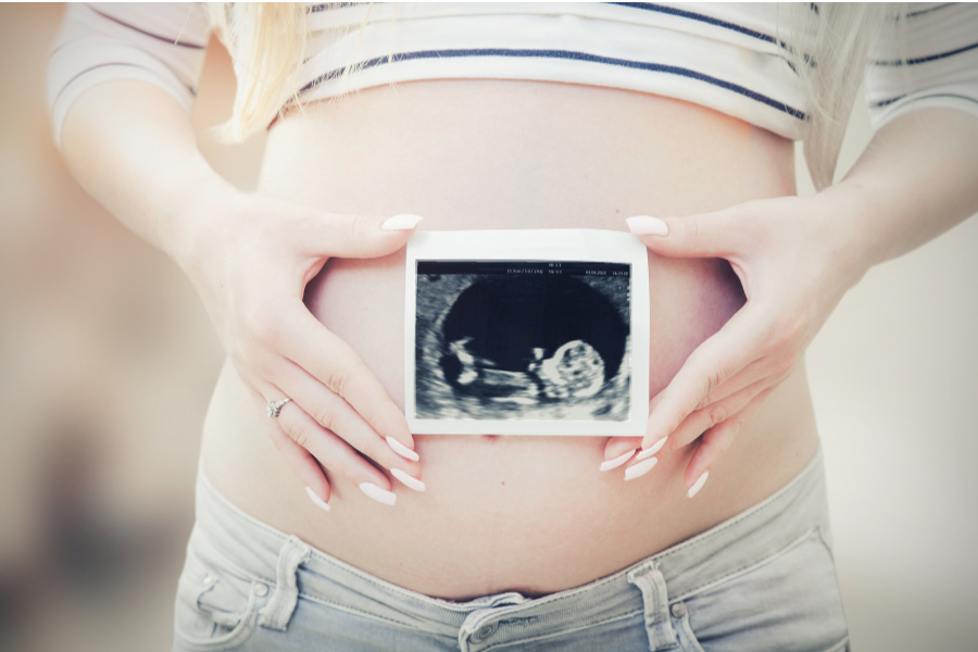 Fetus u desetom tjednu počinje ličiti na novorođenče iako je dugačak svega tri centimetra.