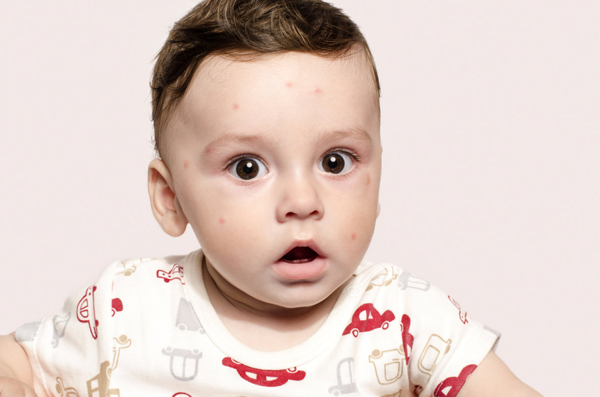 Bebe obožavaju biti vani i otkrivati svijet. A tek kad počinju puzati i hodati... Bilo bi još ljepše kada ne bi postojali komarci.